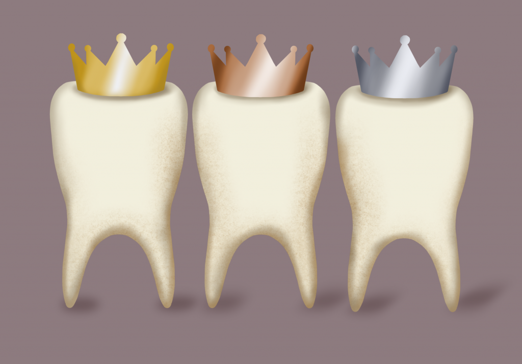 Dental Materials Questions