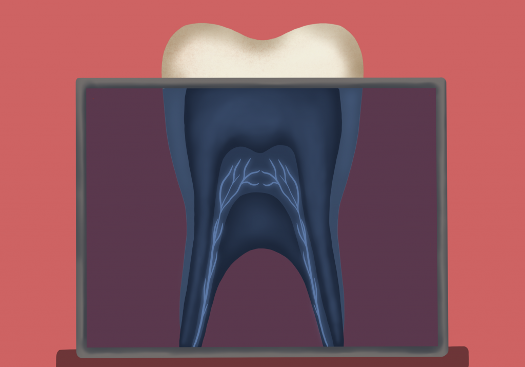 Dental Radiology Questions