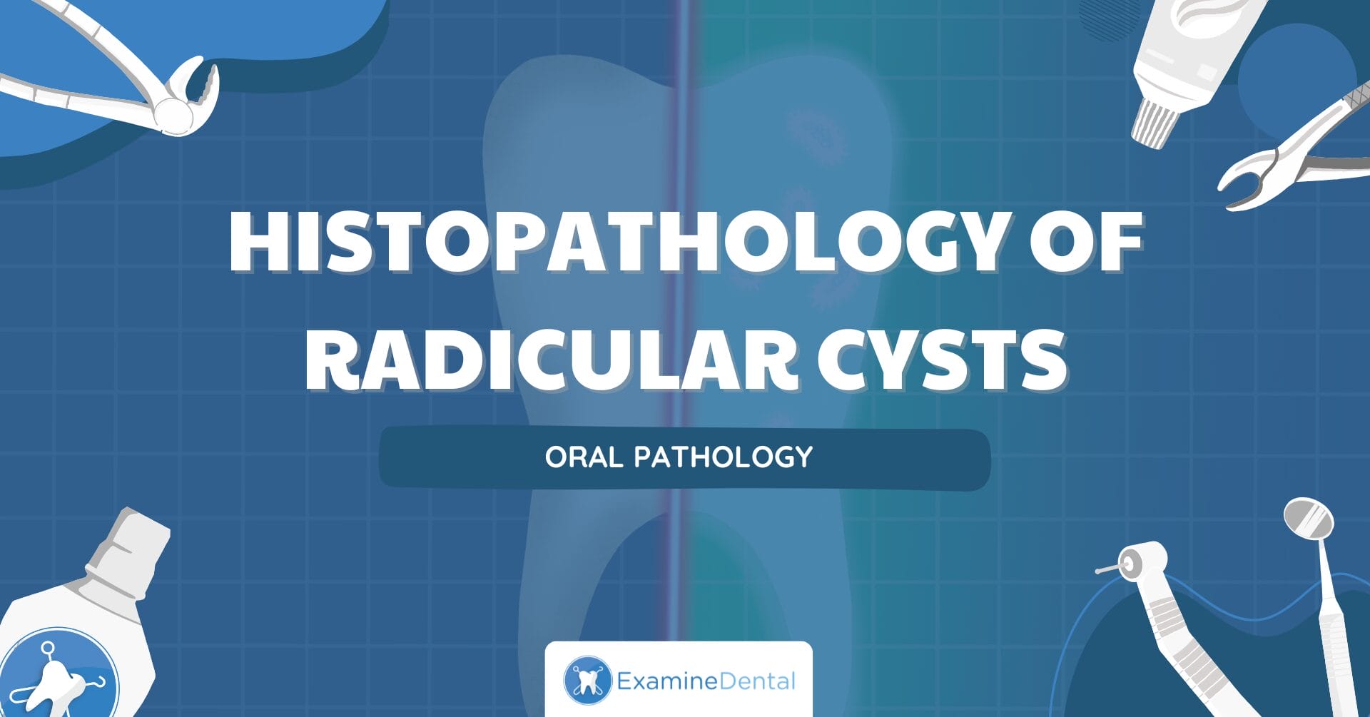 Histopathology of Radicular Cysts
